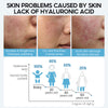 Hyaluronic Acid Face Serum – Anti-Aging, Pore Minimizing, Skin Whitening & Moisturizing